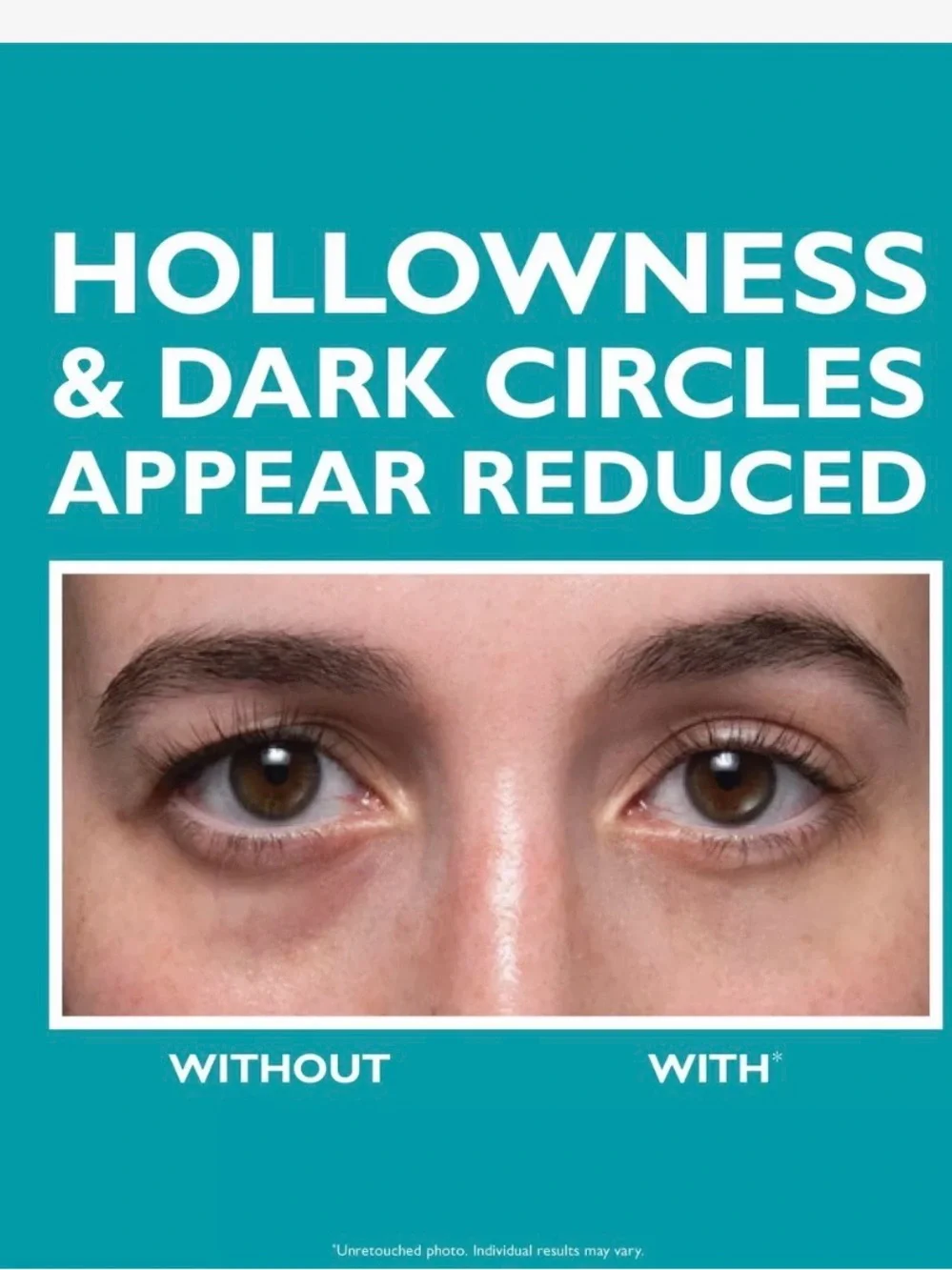 PETERTHOMASROTH peptide injection hydra-gel patches